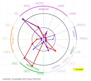 grafico rappresentativo del bilancio posturale